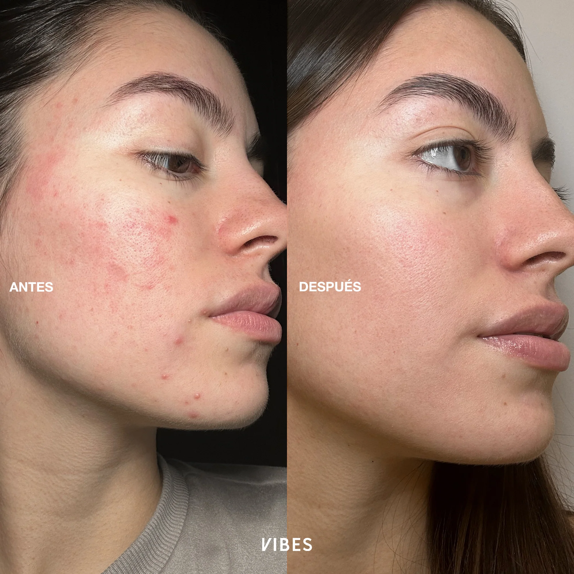 Imagen del producto 7