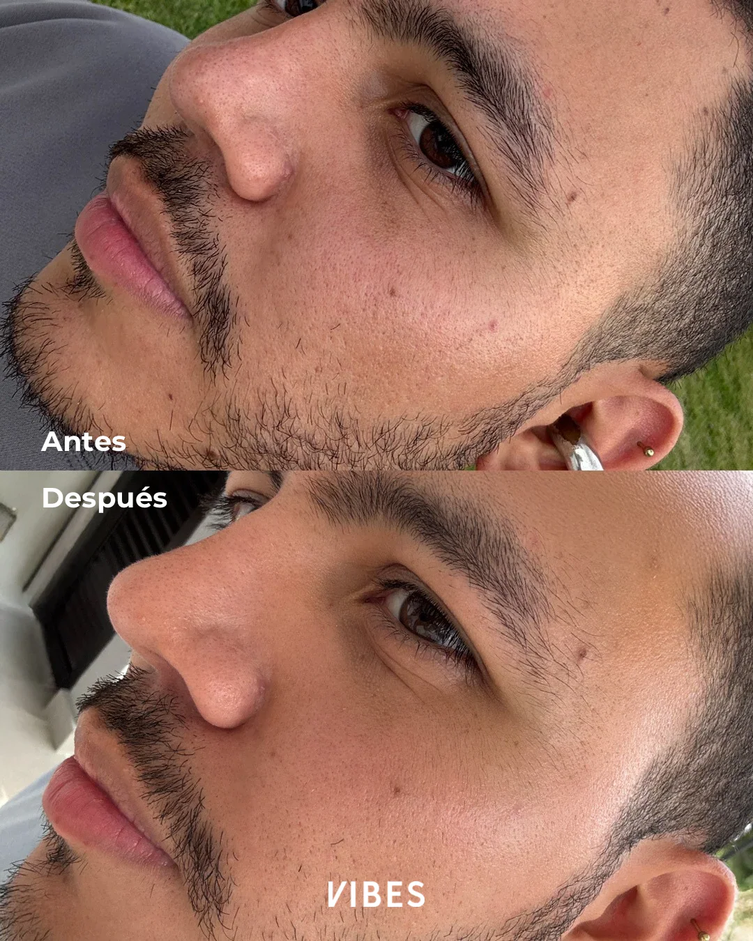 Imagen del producto 7